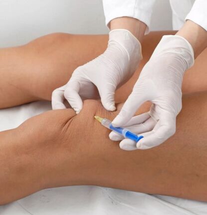 Ozonoterapia