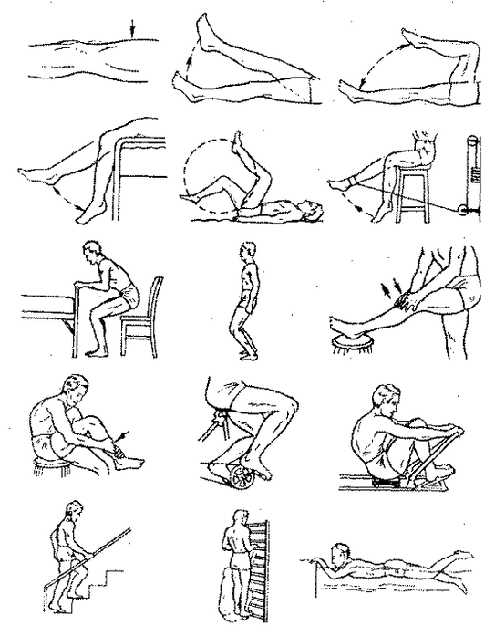 Exercícios terapêuticos para artrose da articulação do joelho