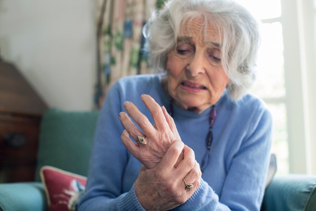 artrose das articulações das mãos em uma mulher idosa
